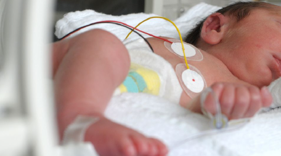 DIRE - A Verona trapiantato un cuore su una bimba di 11 mesi: “È come ...